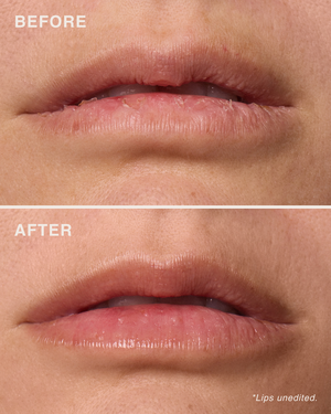 مقشّر الشفاه بأحماض الألفا هيدروكسي (AHA)