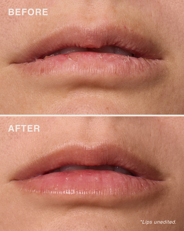 مقشّر الشفاه بأحماض الألفا هيدروكسي (AHA)