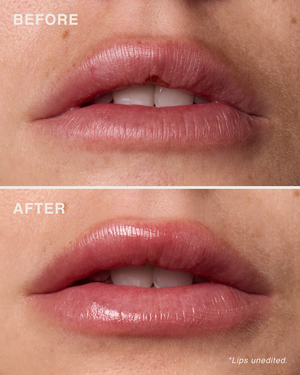 مقشّر الشفاه بأحماض الألفا هيدروكسي (AHA)