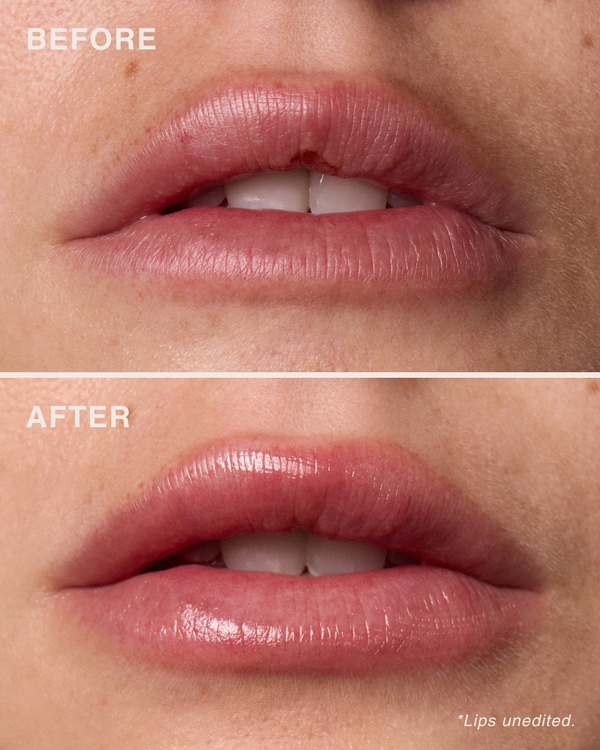 مقشّر الشفاه بأحماض الألفا هيدروكسي (AHA)