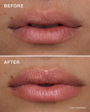 مقشّر الشفاه بأحماض الألفا هيدروكسي (AHA)