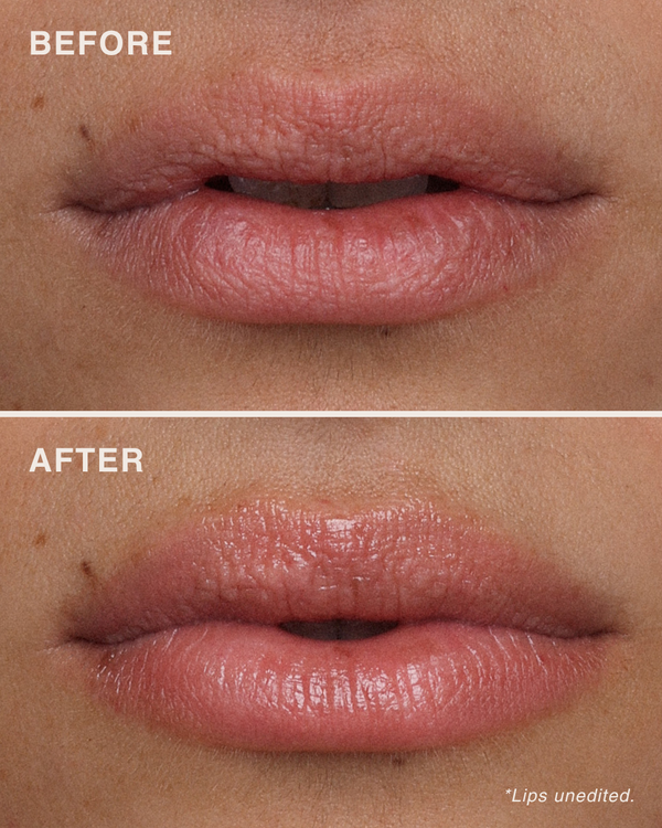 مقشّر الشفاه بأحماض الألفا هيدروكسي (AHA)