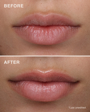 مقشّر الشفاه بأحماض الألفا هيدروكسي (AHA)